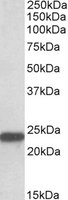 Western blot - Anti-SOD2/MnSOD antibody (AB118340), expandable thumbnail