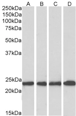 Western blot - Anti-SOD2/MnSOD antibody (AB118340)