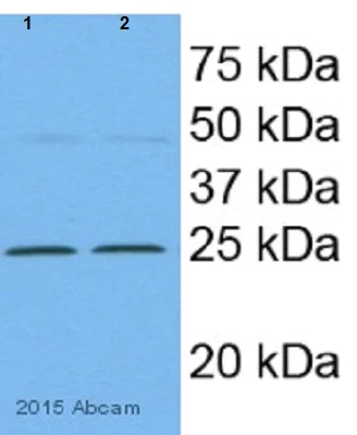 Western blot - Anti-SOD2/MnSOD antibody (AB13533)
