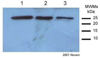 Western blot - Anti-SOD2/MnSOD antibody (AB13533)