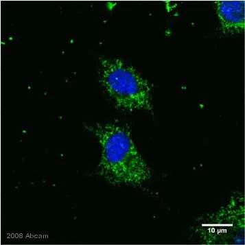 Immunocytochemistry/ Immunofluorescence - Anti-SOD2/MnSOD antibody (AB13534)