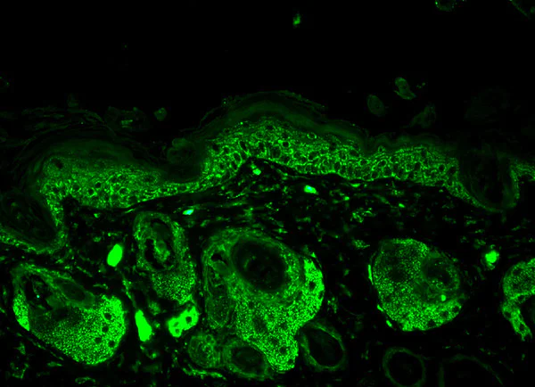 Immunohistochemistry (Formalin/PFA-fixed paraffin-embedded sections) - Anti-SOD2/MnSOD antibody (AB13534)