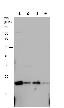 Western blot - Anti-SOD2/MnSOD antibody (AB227091)