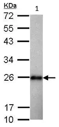 Western blot - Anti-SOD2/MnSOD antibody (AB227091)