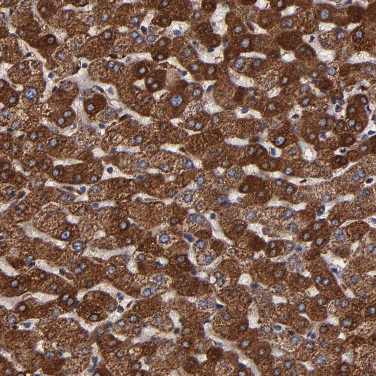 Immunohistochemistry (Formalin/PFA-fixed paraffin-embedded sections) - Anti-SOD2/MnSOD antibody (AB246860)