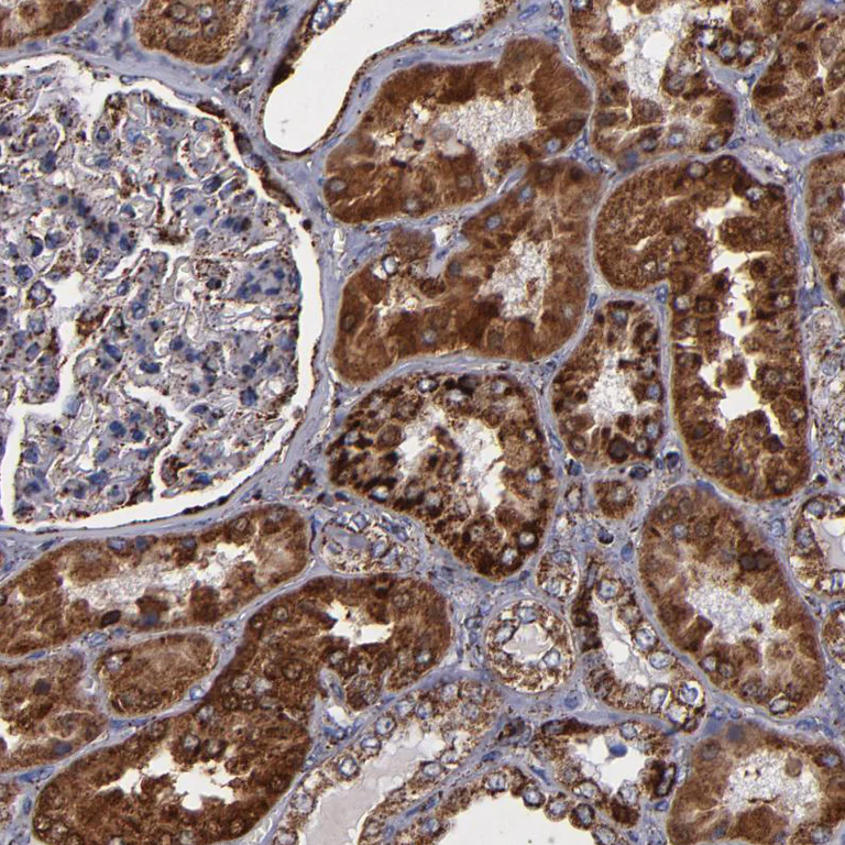 Immunohistochemistry (Formalin/PFA-fixed paraffin-embedded sections) - Anti-SOD2/MnSOD antibody (AB246860)