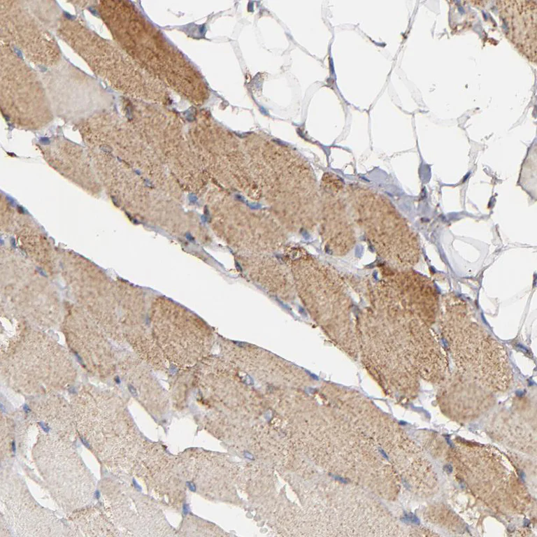 Immunohistochemistry (Formalin/PFA-fixed paraffin-embedded sections) - Anti-SOD2/MnSOD antibody (AB246860)