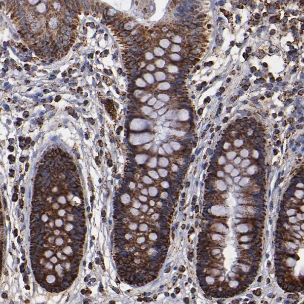 Immunohistochemistry (Formalin/PFA-fixed paraffin-embedded sections) - Anti-SOD2/MnSOD antibody (AB246860)