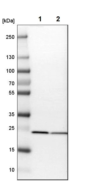 Western blot - Anti-SOD2/MnSOD antibody (AB246860)
