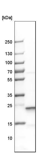 Western blot - Anti-SOD2/MnSOD antibody (AB246860)