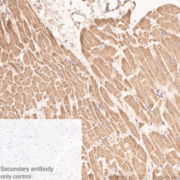 Immunohistochemistry (Formalin/PFA-fixed paraffin-embedded sections) - Anti-SOD2/MnSOD antibody [EPR2560Y] (AB68155)