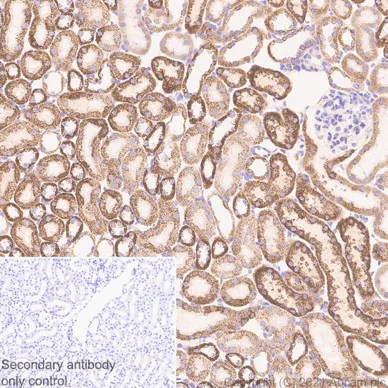 Immunohistochemistry (Formalin/PFA-fixed paraffin-embedded sections) - Anti-SOD2/MnSOD antibody [EPR2560Y] (AB68155)