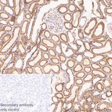 Immunohistochemistry (Formalin/PFA-fixed paraffin-embedded sections) - Anti-SOD2/MnSOD antibody [EPR2560Y] (AB68155)