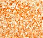Immunohistochemistry (Formalin/PFA-fixed paraffin-embedded sections) - Anti-SOD2/MnSOD antibody [EPR2560Y] - BSA and Azide free (AB227846)