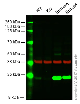 Western blot - Anti-SOD2/MnSOD antibody [EPR2560Y] - BSA and Azide free (AB227846)