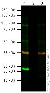 Western blot - Anti-SOD2/MnSOD antibody [mAbcam 74231] (AB74231), expandable thumbnail