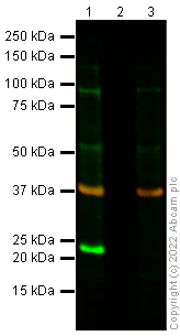 Western blot - Anti-SOD2/MnSOD antibody [mAbcam 74231] (AB74231)
