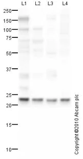 Western blot - Anti-SOD2/MnSOD antibody [mAbcam 74231] (AB74231)