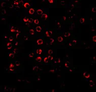 Immunocytochemistry/ Immunofluorescence - Anti-SODD antibody (AB2048)
