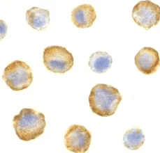 Immunocytochemistry/ Immunofluorescence - Anti-SODD antibody (AB2048)