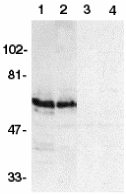 Western blot - Anti-SODD antibody (AB2048), expandable thumbnail