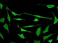 Immunocytochemistry/ Immunofluorescence - Anti-SODD antibody [EPR3596] (AB108988)