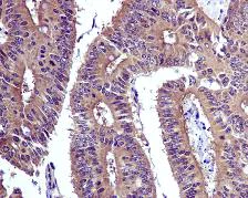 Immunohistochemistry (Formalin/PFA-fixed paraffin-embedded sections) - Anti-SODD antibody [EPR3597] - BSA and Azide free (AB248659)