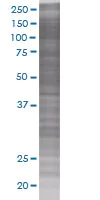 SDS-PAGE - SODD overexpression 293T Transfected lysate (whole cell) (AB94231)