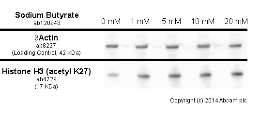 Western blot - Sodium butyrate, Histone deacetylase inhibitor (AB120948), expandable thumbnail