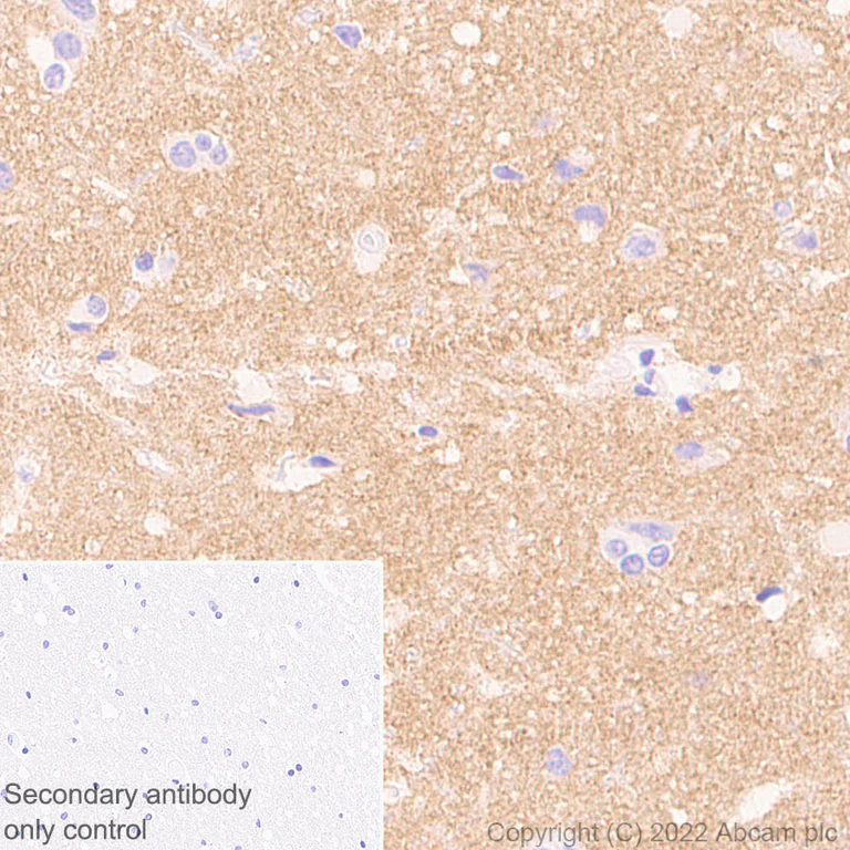 Immunohistochemistry (Formalin/PFA-fixed paraffin-embedded sections) - Anti-Sodium/calcium exchanger 2 antibody [EPR25106-37] (AB300455)