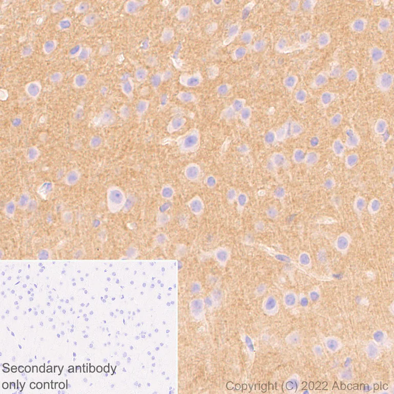 Immunohistochemistry (Formalin/PFA-fixed paraffin-embedded sections) - Anti-Sodium/calcium exchanger 2 antibody [EPR25106-37] (AB300455)