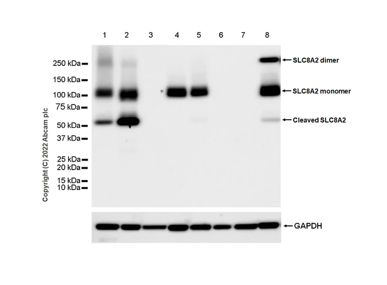 Western blot - Anti-Sodium/calcium exchanger 2 antibody [EPR25106-37] (AB300455)