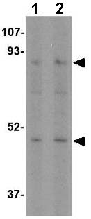 Western blot - Anti-Sodium/Hydrogen Exchanger 1/NHE-1 antibody (AB67313)