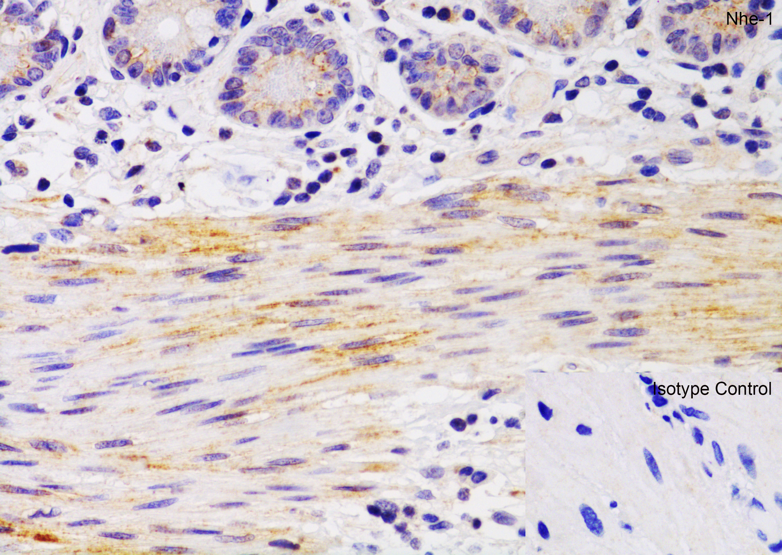 Immunohistochemistry (Formalin/PFA-fixed paraffin-embedded sections) - Anti-Sodium/Hydrogen Exchanger 1/NHE-1 antibody (AB67314), expandable thumbnail