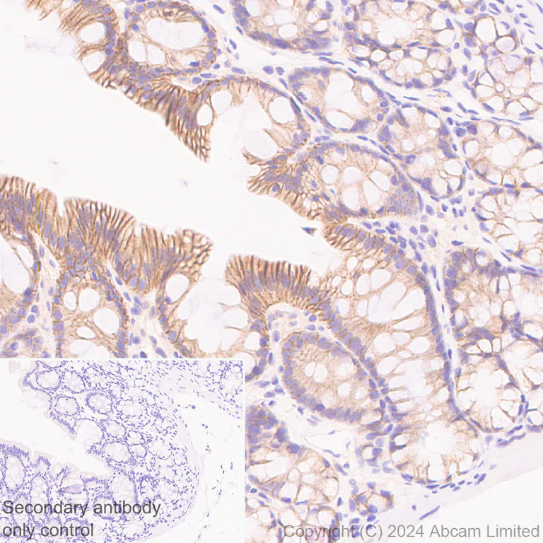 Immunohistochemistry (Formalin/PFA-fixed paraffin-embedded sections) - Anti-Sodium/Hydrogen Exchanger 1/NHE-1 antibody [EPR28913-51] (AB322349)
