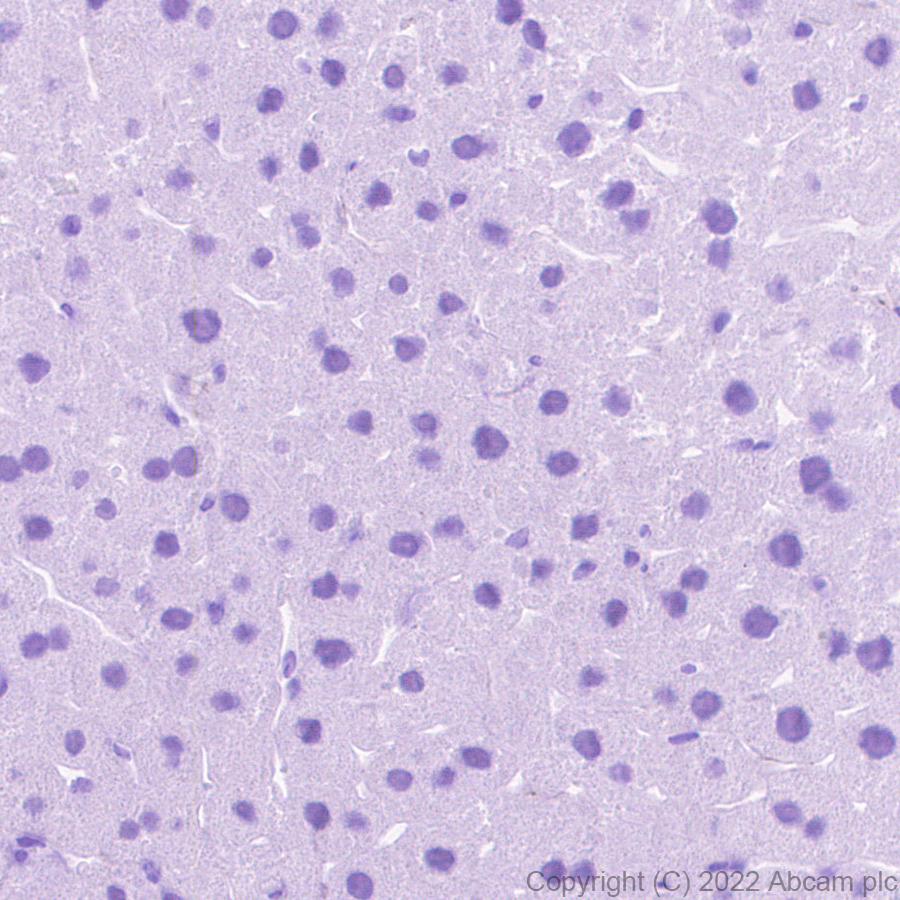 Immunohistochemistry (Formalin/PFA-fixed paraffin-embedded sections) - Anti-Sodium/Hydrogen Exchanger 3/NHE-3 antibody [EPR26951-3] (AB307365)
