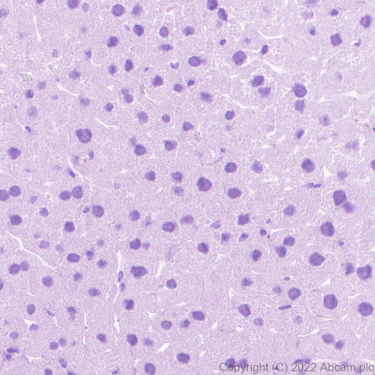 Immunohistochemistry (Formalin/PFA-fixed paraffin-embedded sections) - Anti-Sodium/Hydrogen Exchanger 3/NHE-3 antibody [EPR26951-3] - BSA and Azide free (AB307366)