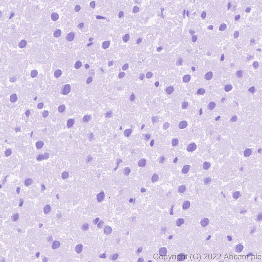 Immunohistochemistry (Formalin/PFA-fixed paraffin-embedded sections) - Anti-Sodium/Hydrogen Exchanger 3/NHE-3 antibody [EPR26951-3] - BSA and Azide free (AB307366), expandable thumbnail