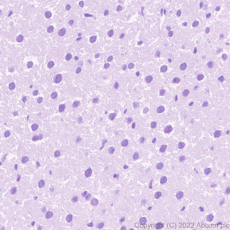 Immunohistochemistry (Formalin/PFA-fixed paraffin-embedded sections) - Anti-Sodium/Hydrogen Exchanger 3/NHE-3 antibody [EPR26951-3] - BSA and Azide free (AB307366)
