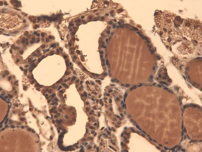 Immunohistochemistry (Formalin/PFA-fixed paraffin-embedded sections) - Anti-Sodium Iodide Symporter antibody [FP5] (AB242007)
