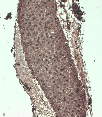 Immunohistochemistry (Formalin/PFA-fixed paraffin-embedded sections) - Anti-Sodium Iodide Symporter antibody [FP5] (AB242007)