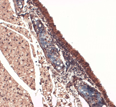 Immunohistochemistry (Formalin/PFA-fixed paraffin-embedded sections) - Anti-Sodium Iodide Symporter antibody [FP5] (AB242007)