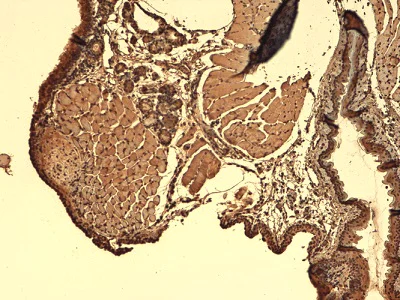 Immunohistochemistry (Formalin/PFA-fixed paraffin-embedded sections) - Anti-Sodium Iodide Symporter antibody [FP5] (AB242007)