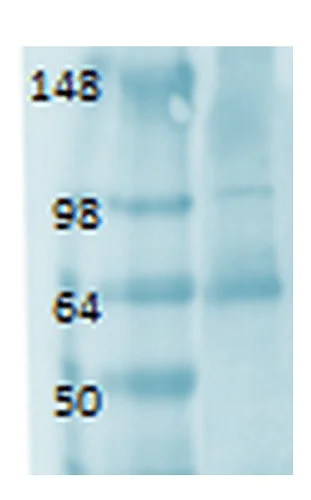 Western blot - Anti-Sodium Iodide Symporter antibody [FP5] (AB242007)