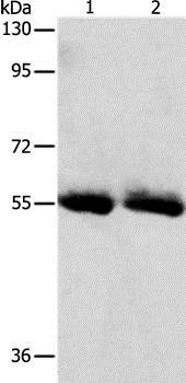 Western blot - Anti-Sodium Iodide Symporter antibody - N-terminal (AB199410)