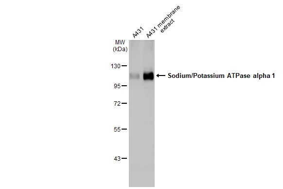 Western blot - Anti-Sodium Potassium ATPase alpha 1 antibody [HL114] - Plasma Membrane Loading Control (ab308329), expandable thumbnail