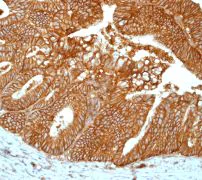 Immunohistochemistry (Formalin/PFA-fixed paraffin-embedded sections) - Anti-Sodium Potassium ATPase antibody [EP1845Y] - BSA and Azide free (AB167390)
