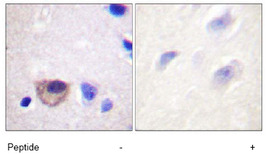 Immunohistochemistry (Formalin/PFA-fixed paraffin-embedded sections) - Anti-Sodium Potassium ATPase antibody - Plasma Membrane Marker (AB58475), expandable thumbnail