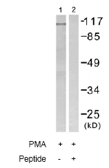 Western blot - Anti-Sodium Potassium ATPase antibody - Plasma Membrane Loading Control (AB58475)