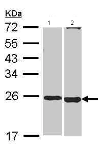 Western blot - Anti-Sohlh2 antibody (AB101402)